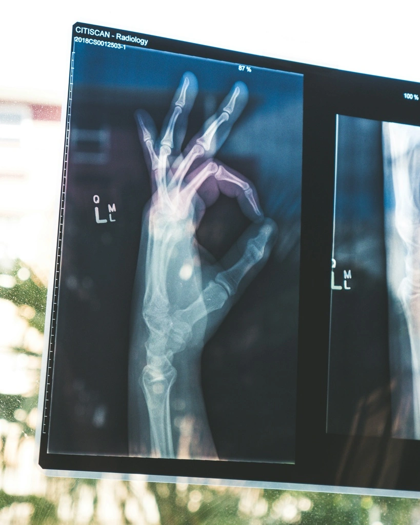 An X-ray image of a human hand making an 'OK' gesture, displayed on a backlit screen, with radiology details visible at the top. Luma Health insurance review